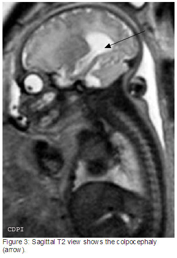 Figure3