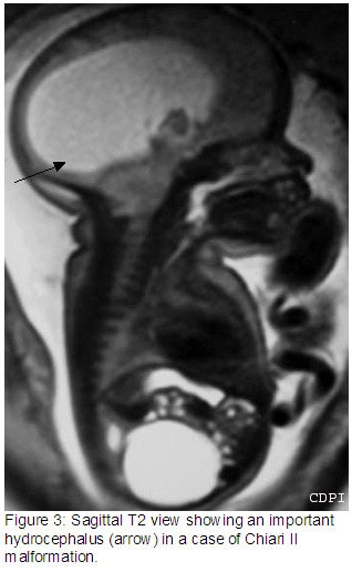 Figure3
