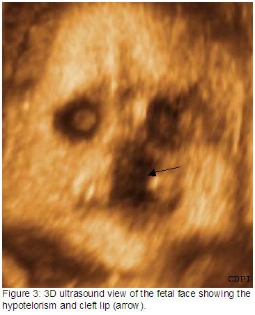 Figure3