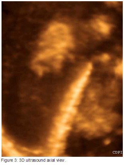Figure3