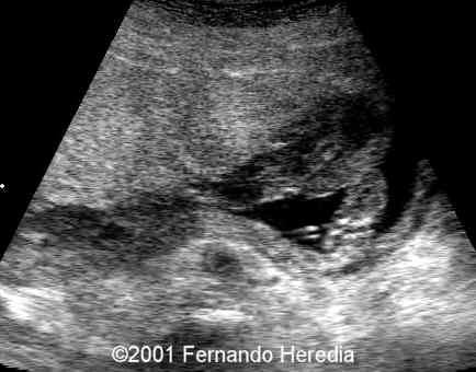 figure3