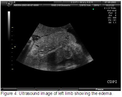 figure4