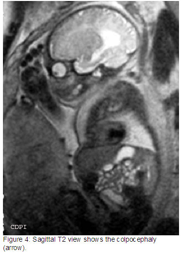Figure4