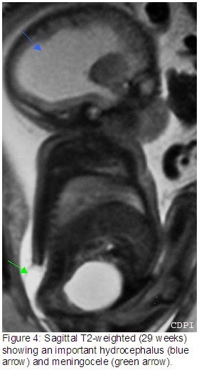 Figure4