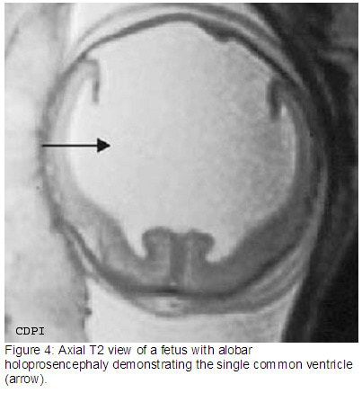 Figure4