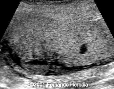 figure4