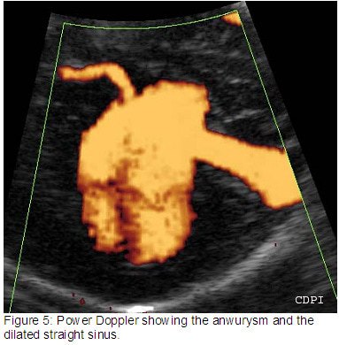 Figure5