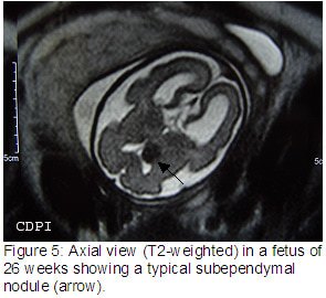 Figure5