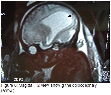 Figure6
