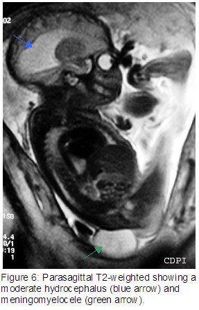 Figure6