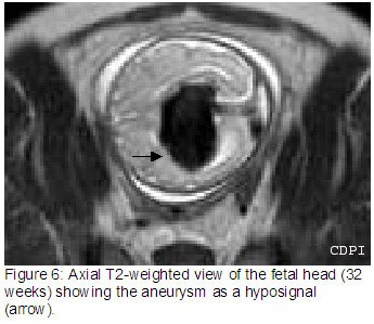 Figure6
