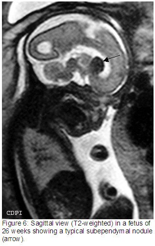 Figure6