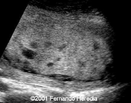 figure6
