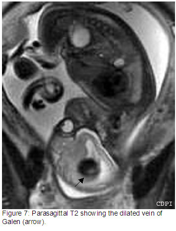 Figure7