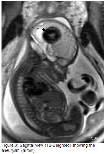 Figure8