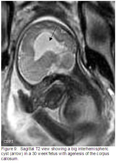 Figure9