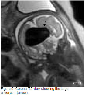 Figure9
