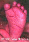 foot