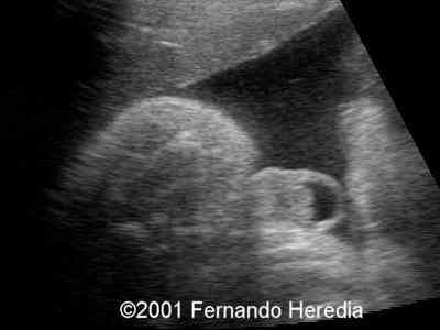 frontal3