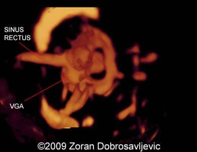 Galen_Zoran_6(1)