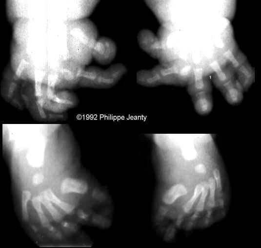 hand