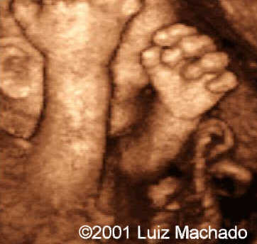 hand1