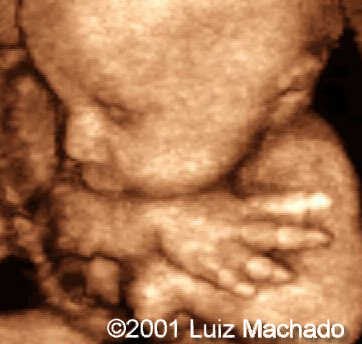 hand10