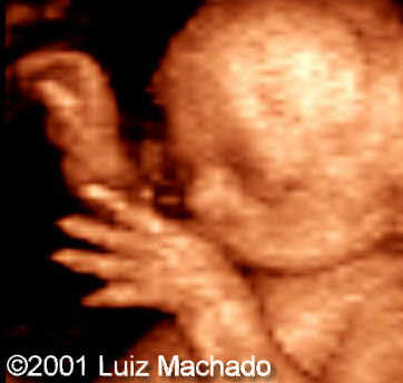 hand2