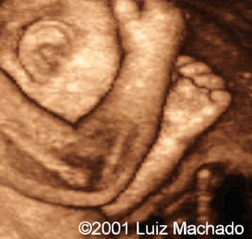 hand3