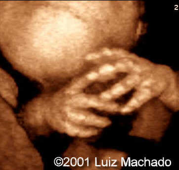 hand5