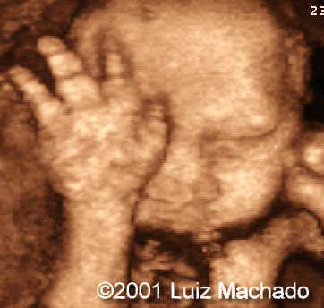 hand6