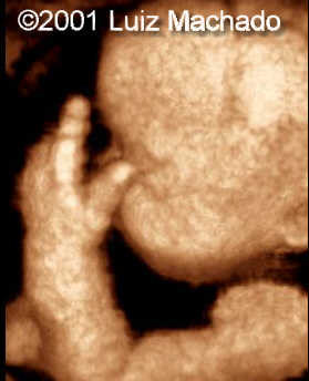 hand7