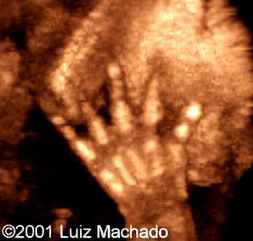 hand9