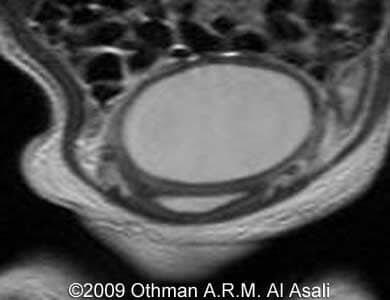 HydroMRI_20
