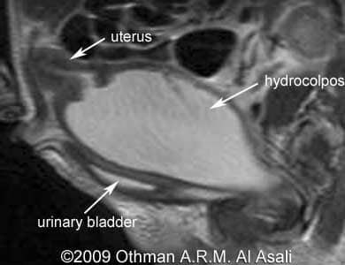 HydroMRI_21