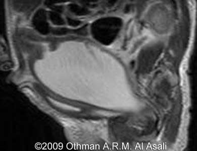 HydroMRI_23