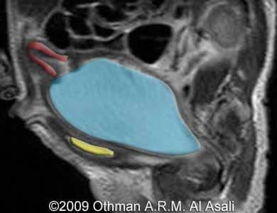 HydroMRI_23a