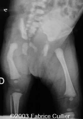 HYPOP F CONG. PHOTO FIG 4