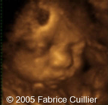 ima11_32weeks