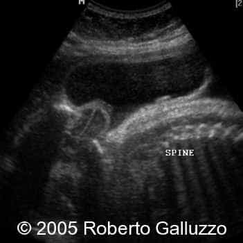 ima3