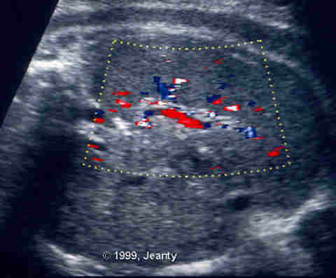 image001