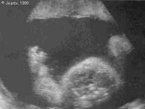 image001