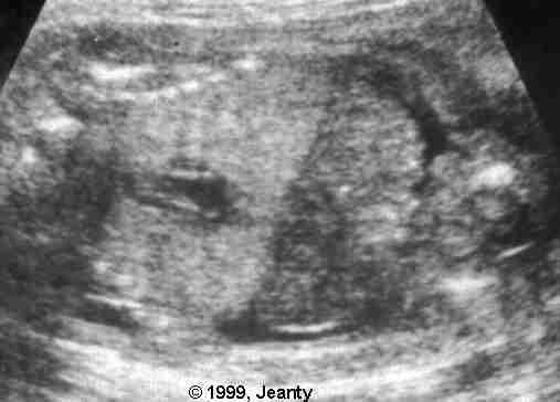 image001