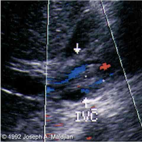 image003
