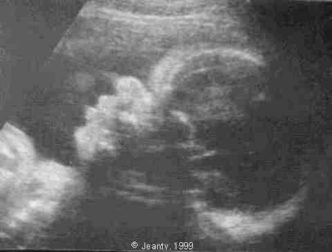 image003