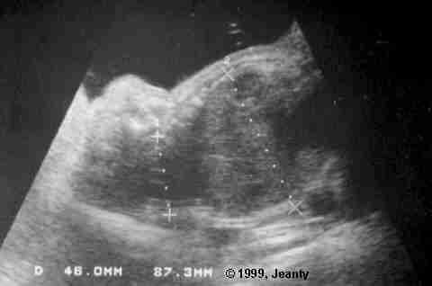 image003