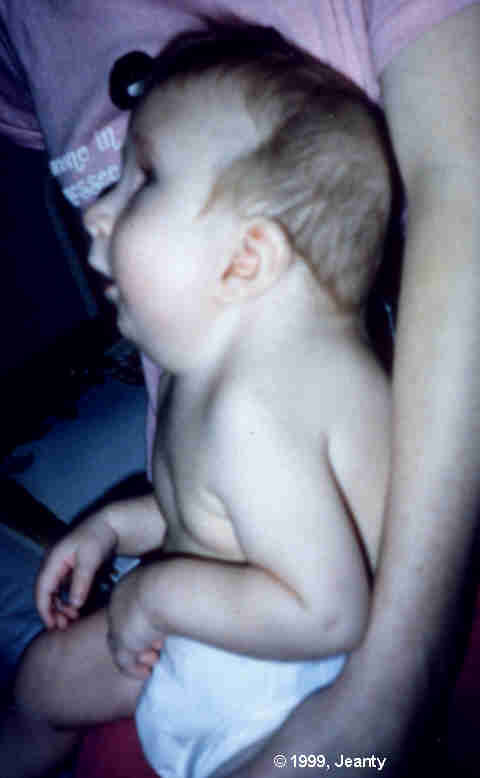 image003