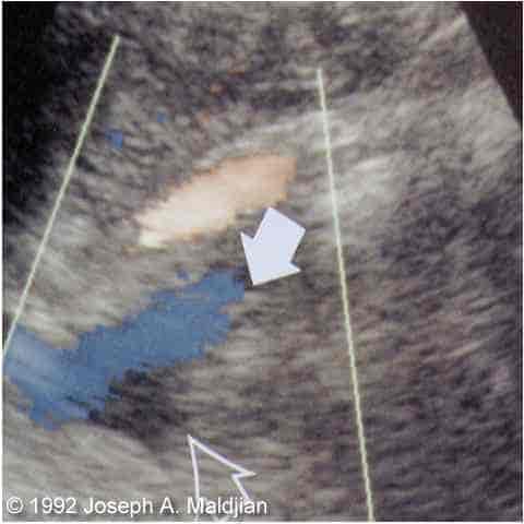 image004