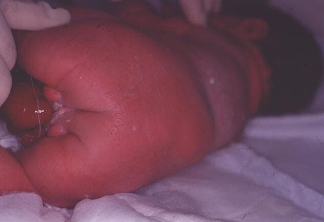 image006