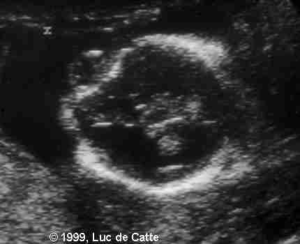 image009